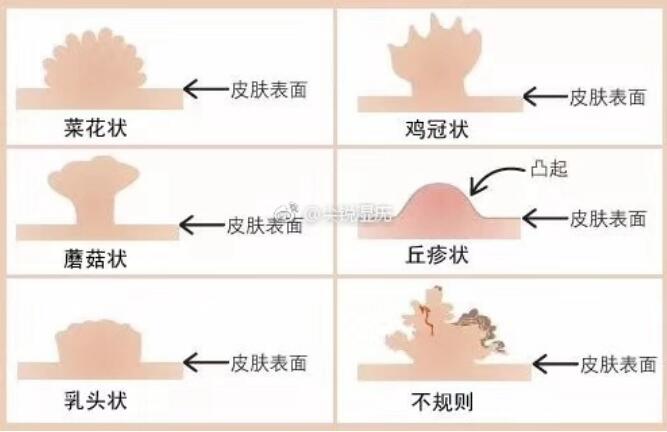 ���ɽ�˻����¼����� Ů�Բ˻�������ô���Ŀ���������