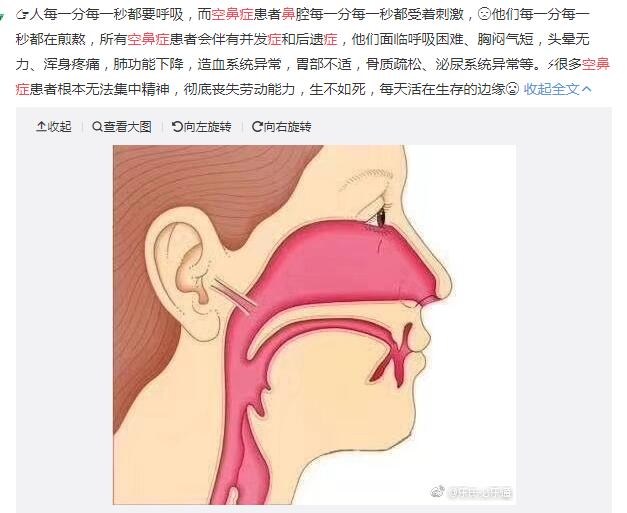 ��̫���Ŀձ�֢������ ���˿ձ�֢�ܻ��