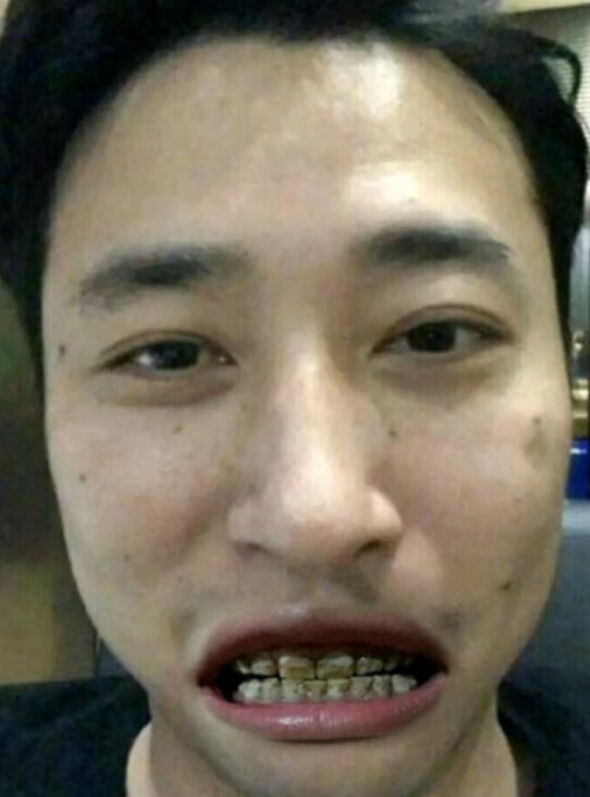 ǮС��Ϊʲô������������ ǮС��401��ʲô��