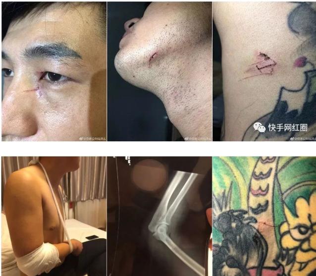 ��Ͻ��������ô���� ��������ľ���������