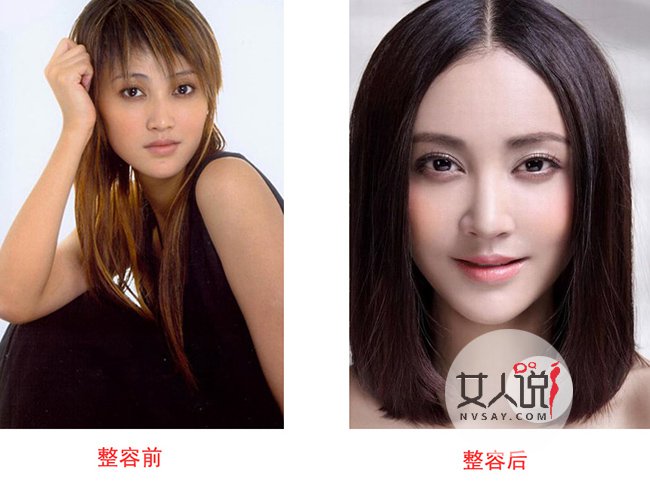张歆艺整容前后对比照片 张歆艺和刘芸为什么翻脸