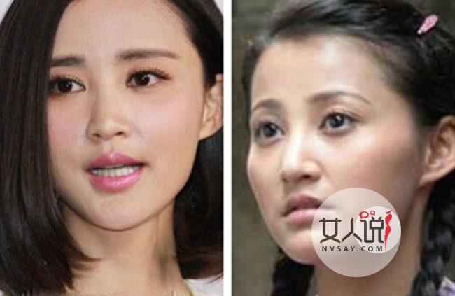 张歆艺整容前后对比照片 张歆艺和刘芸为什么翻脸
