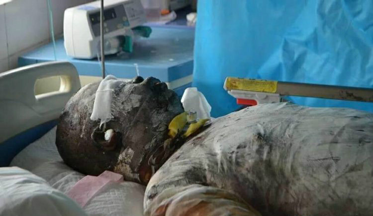 男子三入火海救人 全身被烧黑救援场地满地是血