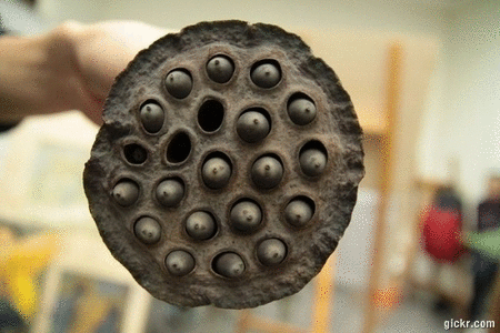 �ܼ��־�֢ͼƬ ���ؿ�ζ�ܼ��־�֢��Ƭ��С����