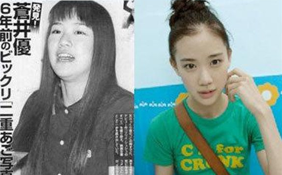 苍井优减肥前后照片 苍井优为什么不红了