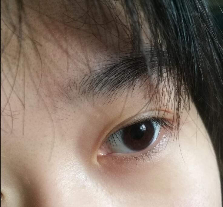 ɽ���͵���������Ĳ����� ����ȱ�������ر���������