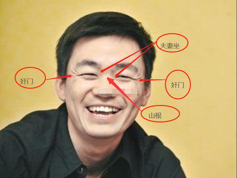 山根低的人命运真的不好吗 容易缺乏自信特别依赖别人