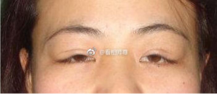 ǰ���������������� ���ཫǰ�������������Ϊ����