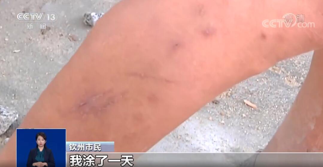 �����ҧ�˺�����ͼƬ �������ҧ����ʲô֢״ ��ô����