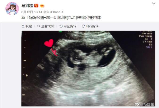 ����Խ�Ϲ��Ž����� ���Ǹ�ʲô������