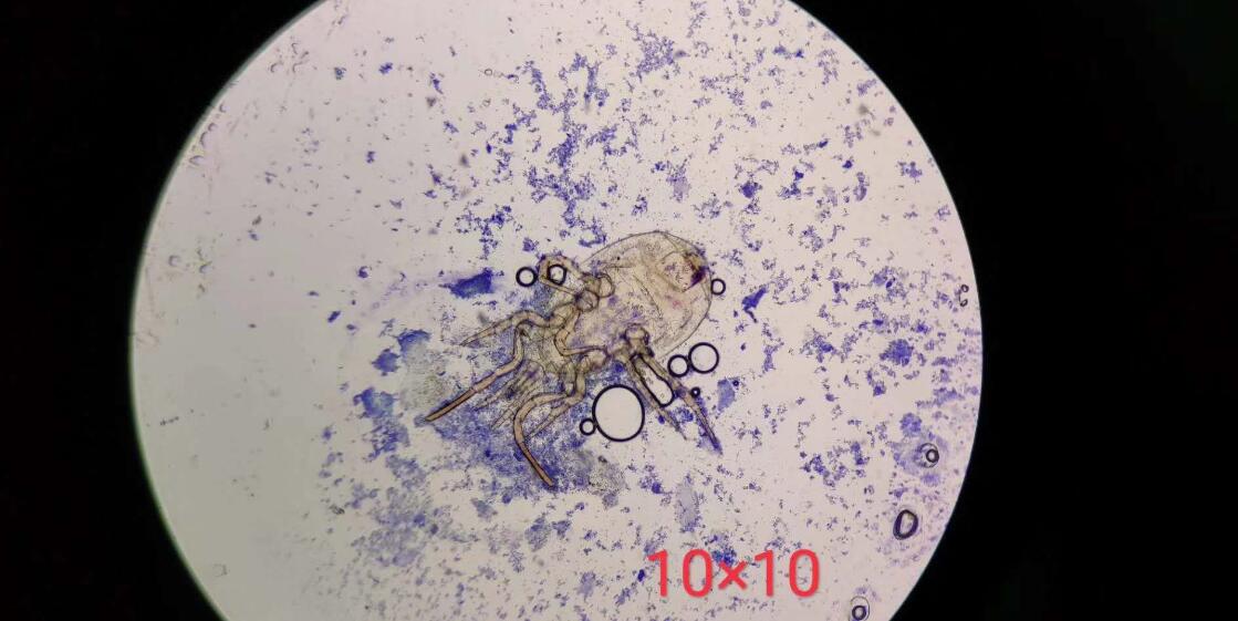 ���涣ҧ���֢״ͼ ����ΪʲôֻҪ���Ӳ�ҧ����