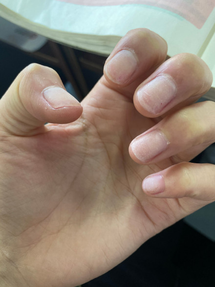 Ů����ָָ�׼���Ԣ�� Ů����ָָ�׶̴���ʲô