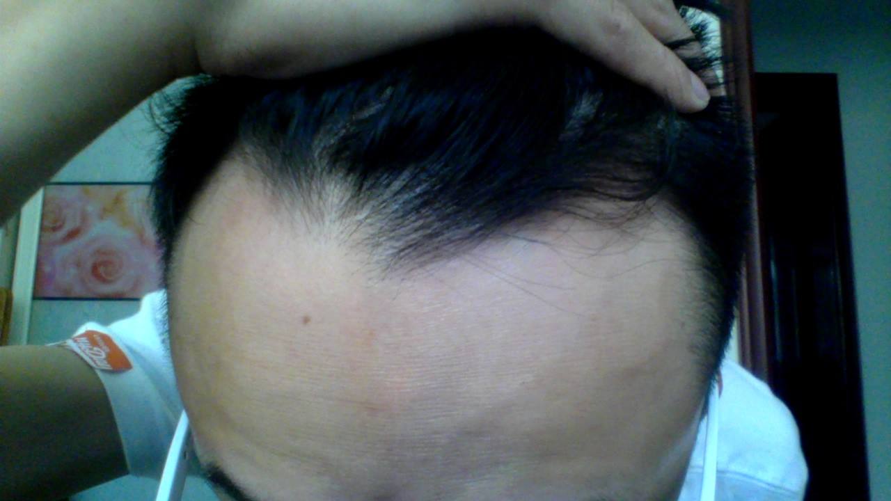 额头长旋的位置图解 额头上有旋的女孩好吗