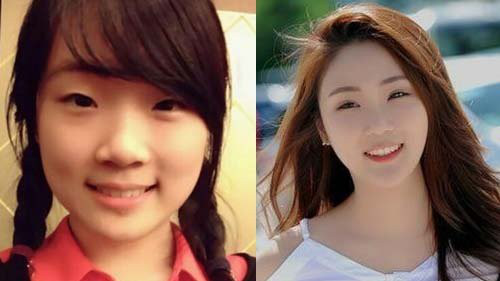 Ϊʲô����˵�ſ�ӯ�����侳��û��ò �ſ�ӯ����ǰ��Ա�ͼƬ