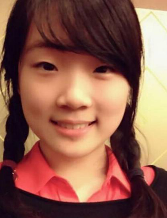 很明显的张可盈小时候的眼睛是个单眼皮啊,现在确实是双眼皮,其他的