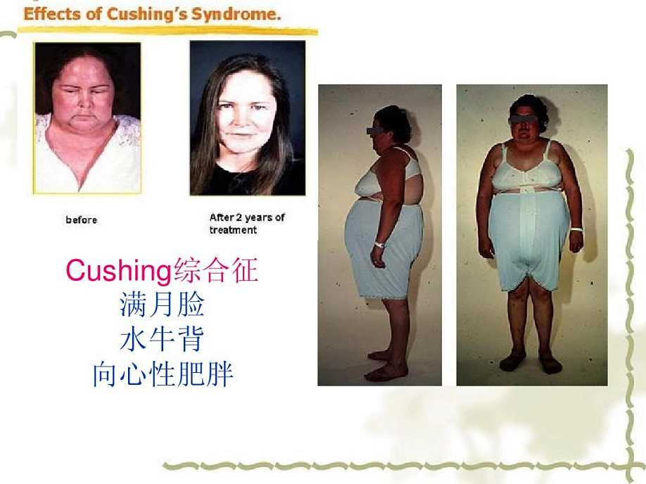 ������ˮţ����ͼƬ ��������ʲô�����µ�