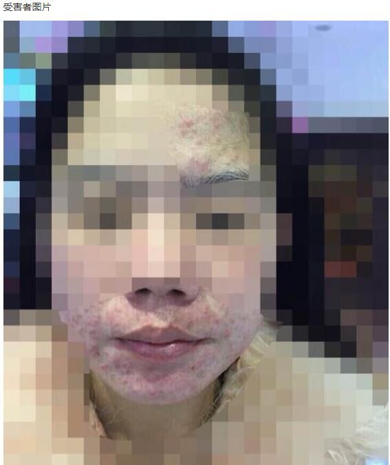 周梦晗卖假面膜后逃到哪里了 周梦晗面膜长毛