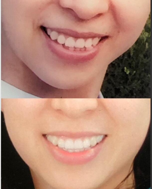 Ϊʲô����������ô�� �������ݽ���ǰ��