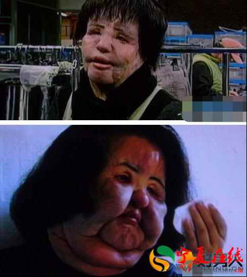 �����ԭ��������(����ǰ) �����������ʱ��ͼƬ