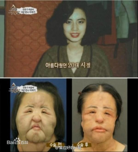 �����ԭ��������(����ǰ) �����������ʱ��ͼƬ