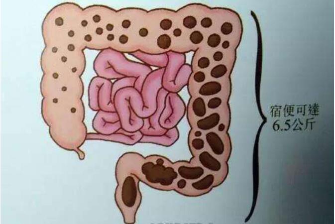 è��������ʮ����ޱ���ʲô�� �ޱ���ʲô��ɫ��״��