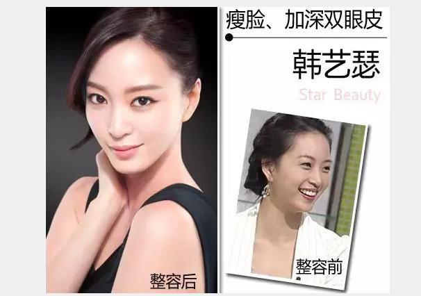 ����ɪ����ǰ��Ա�ͼ�仯���� ����ɪ����������μ������Ǯ��