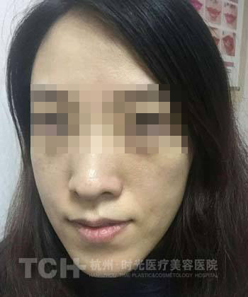 徐璐男朋友确定是张铭恩 徐璐是苦瓜脸吗