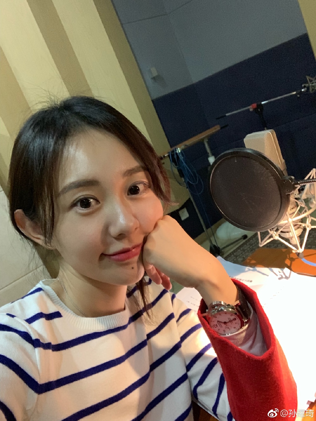 余少群和孙耀琦翻脸对比图 孙耀琦下巴的黑痣有什么说法