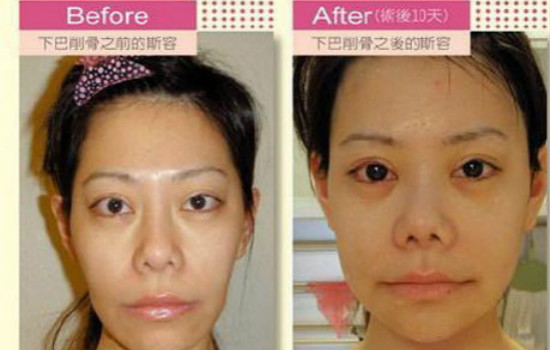 ����2�����֢�ͳ����� ���ݺ���֢��û�����ж����