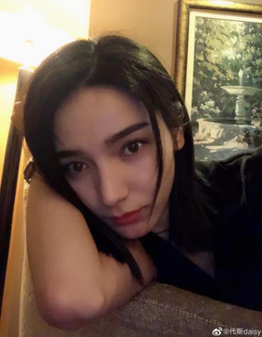 ��˹�����������˹�ϵ�� ��˹�ǲ��ǻ�Ѫ��