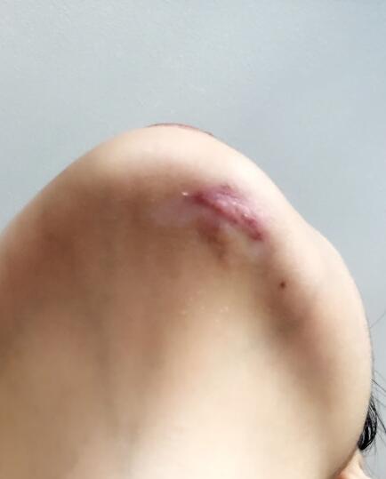 �°��а̺�Ӱ�������� �°͵����и��̺���ʲô����