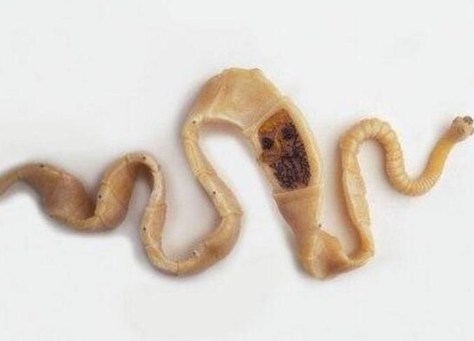 牛带绦虫图片 怎么判断得了牛带绦虫 怎么可以杀死