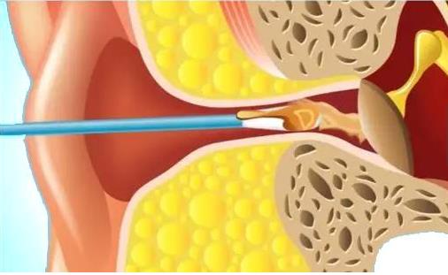 �Ͷ�����ʲô������˼ �Ͷ����ں�ԭ��������