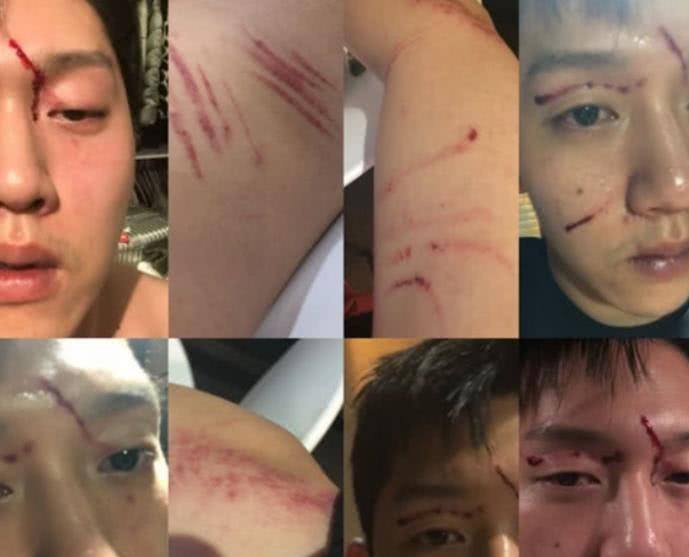 �ߺ����¼�����ȥ�� �ұ��¼�ϸ˼����