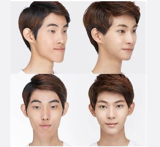 鞋拔子脸是怎么造成的 鞋拔子脸能自然矫正吗