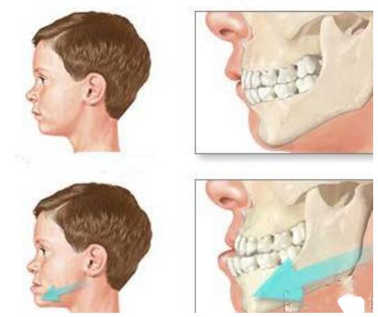 Ь����������ô��ɵ� Ь����������Ȼ������