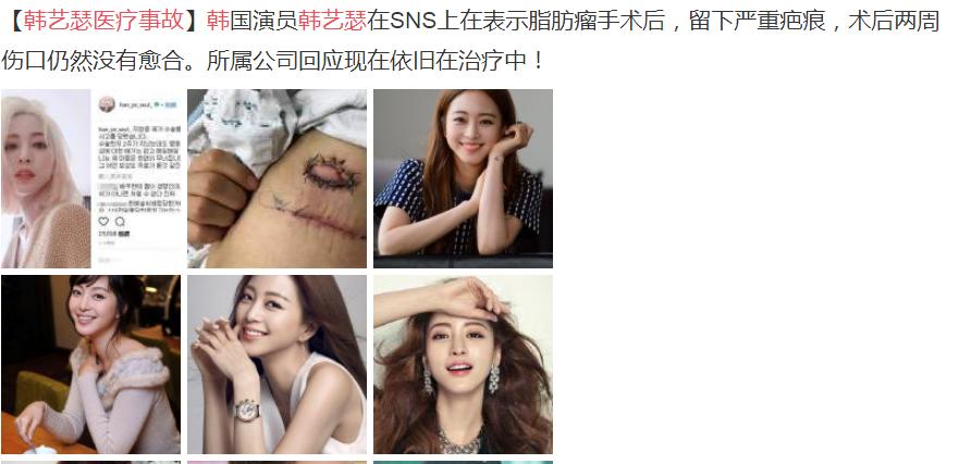 ����ɪҽ���¼�����ô���� ����ɪrunningman�ǵڼ���