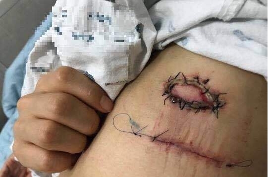 ����ɪҽ���¼�����ô���� ����ɪrunningman�ǵڼ���