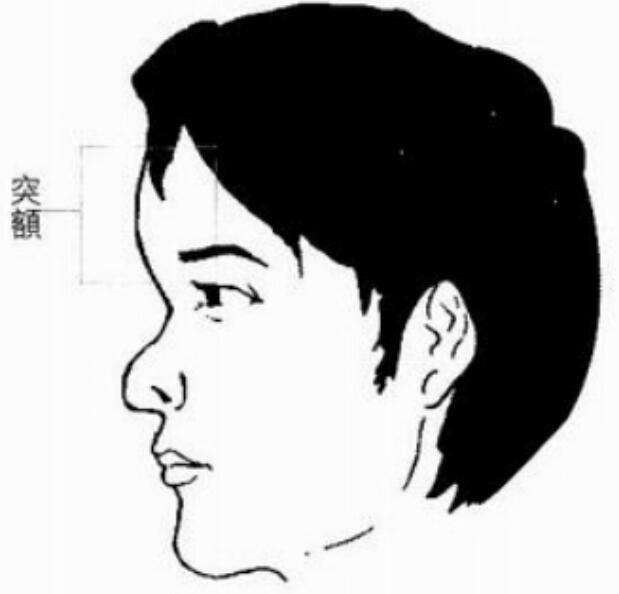 怎样评判额头是否饱满 额头饱满和额头前突如何区别