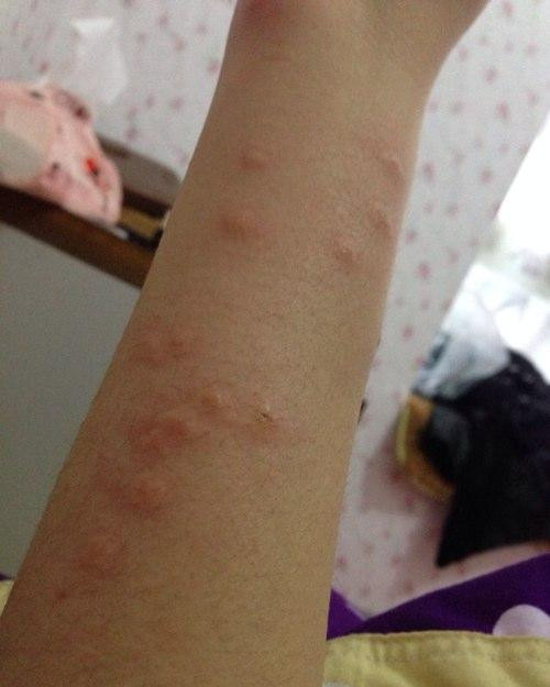 ���ҧ����ͼƬ ������ҧ����ô��