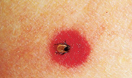 ���ҧ����ͼƬ ������ҧ����ô��