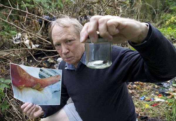 ���Ͽ���֩�����ʲô ������֩��Ҫ��Ҫ����