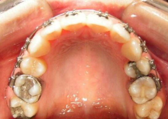 �л������˺ò��� ����Ϊʲô���ܰε�