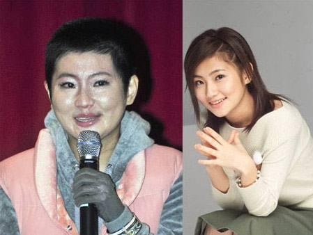 张承中说selina的腿烧伤皮肤像蜂窝 看着想吐是真的吗