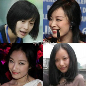 �����۾�����ǰ��Ա�ͼ ���ݵĸ�ĸ��ʵ�����ع�