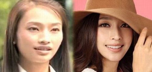 ��ٳ��߶ȳ���¶������Ƭ ��ٳ����ǰ����Ƭ�ع�