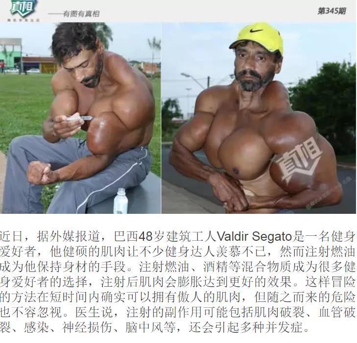 ����ע���ȼ����ʲô�� ��ʲôԭ��