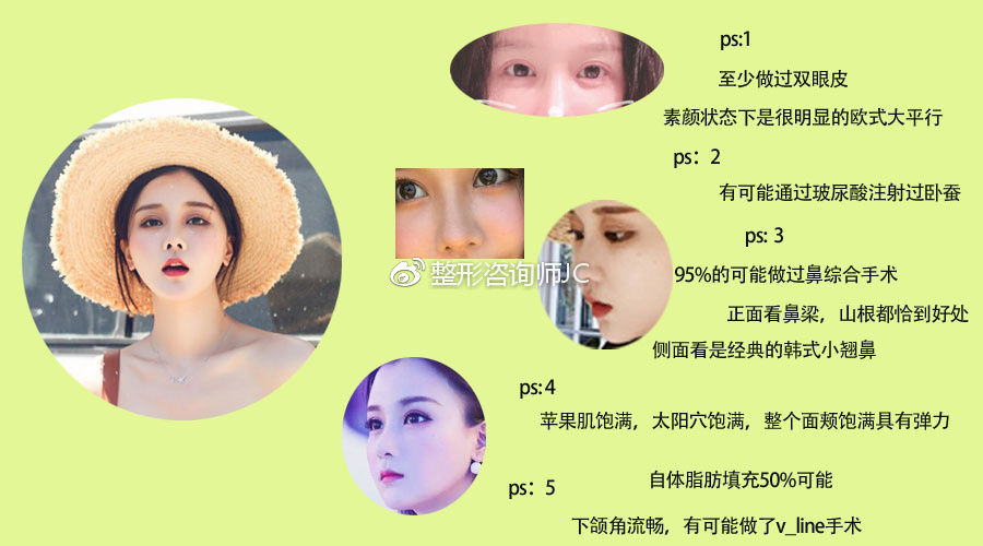 滕雨佳整容前后对比照片 她直播的时候关美颜差点吓死网友