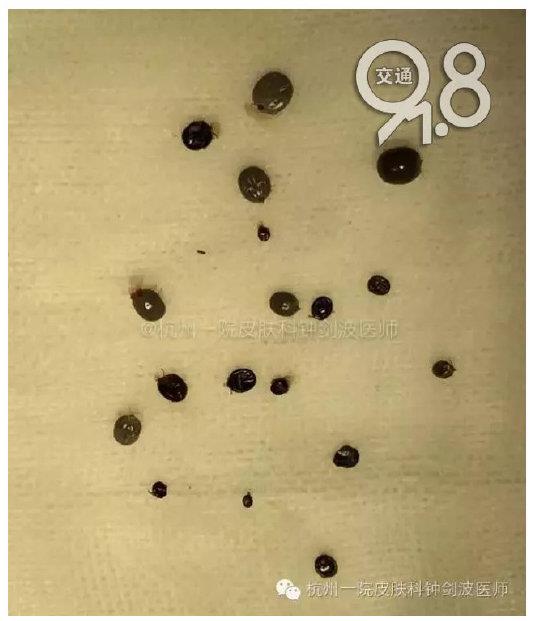 ���Ϊʲô��ҧ���� �����ҧ����ô�����ȫ