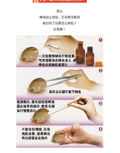 ���Ϊʲô��ҧ���� �����ҧ����ô�����ȫ